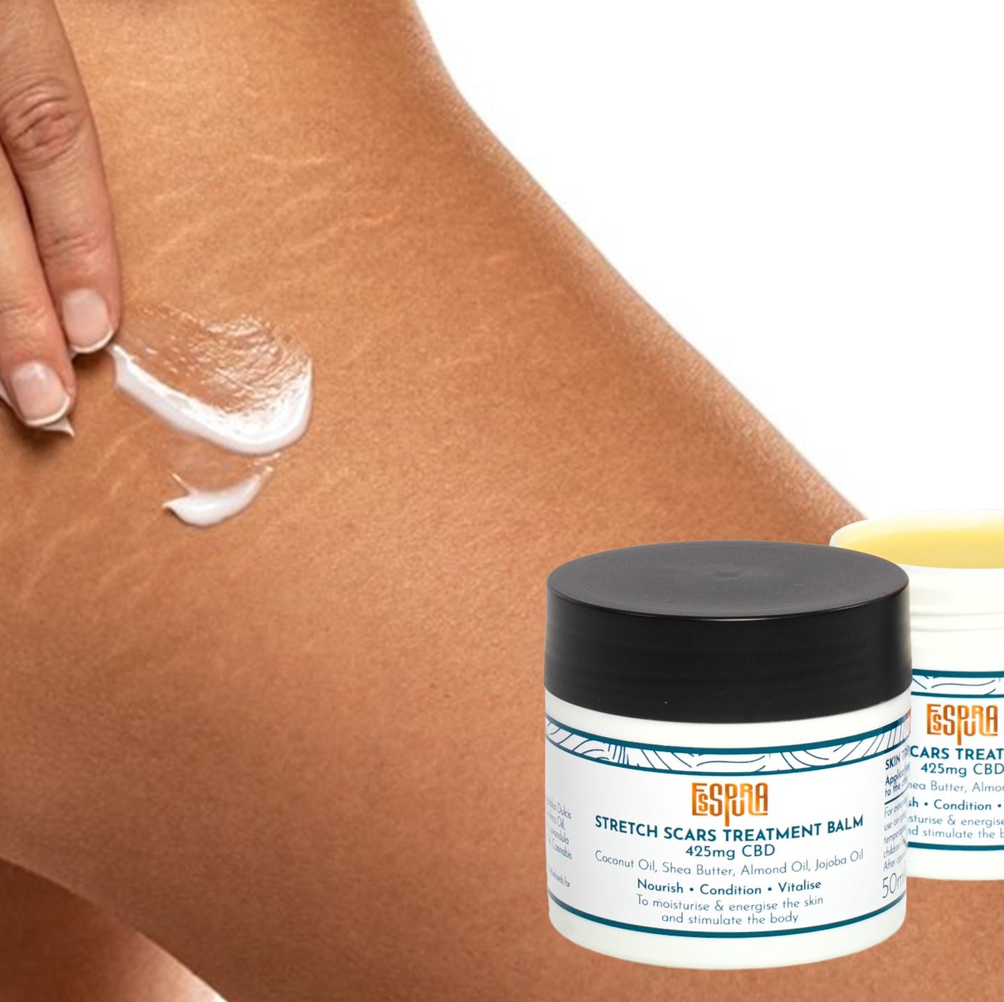 Stretch Scars Treatment Balm